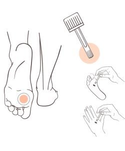 Verrucarom - Solution pieds et mains BIO - 10 ml BIO, 10 ml